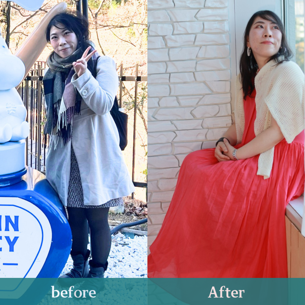 BeforeAfter
